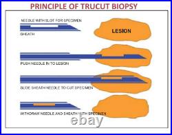 Tru-Cut Biopsy Semi-Automatic 10Pcs